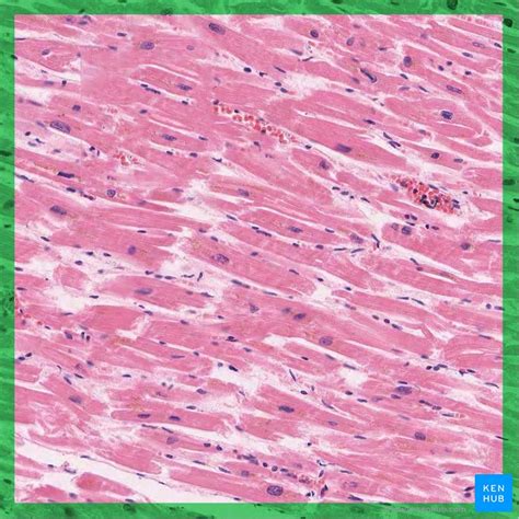 Which of These Characteristics Best Describes Cardiac Muscle Tissue