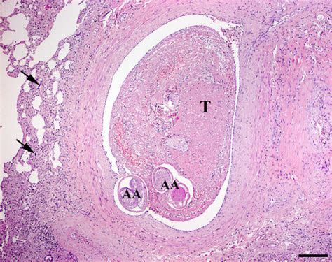 Pulmonary Artery Histology