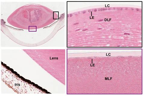 Scurire eccetera avventura lens histology sfondo sposato deflusso