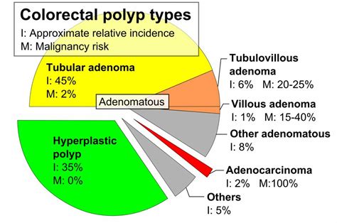 Types Of Colon Polyps Chart