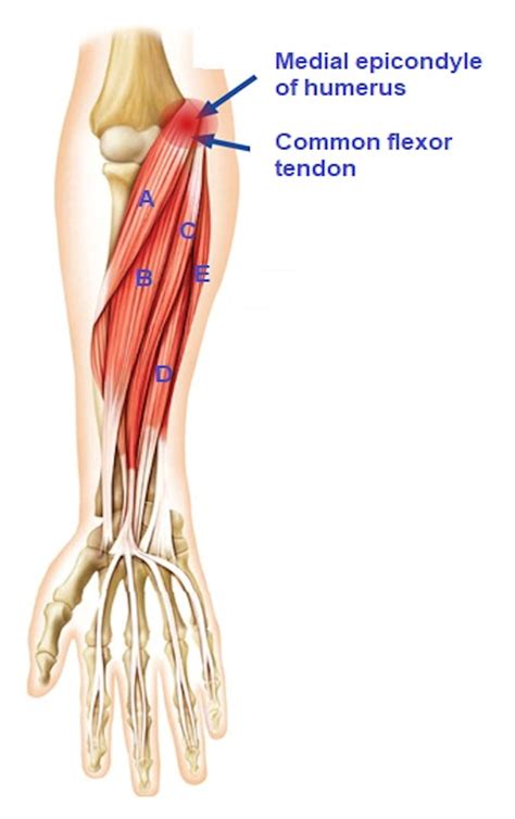 Arcuate Ligament Elbow