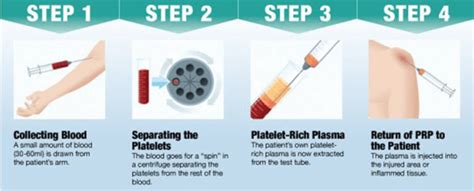 Best Platelet Rich Plasma Therapy (PRP) | Honolulu Hawaii