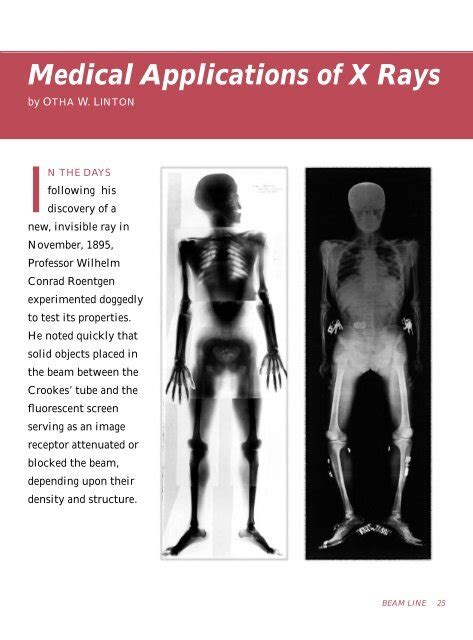 Medical Applications of X Rays - SLAC - Stanford University