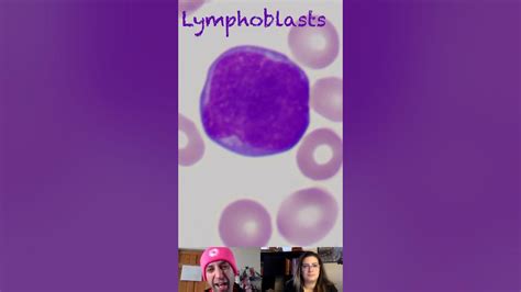 Lymphoblast Morphological Characteristics - YouTube