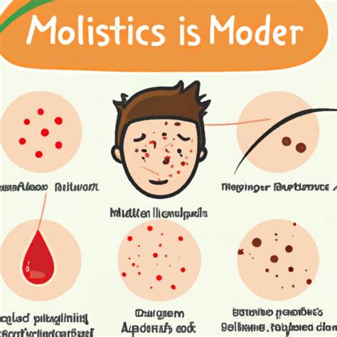 What Are Skin Moles? Causes, Types, Diagnosis, and Treatments - The ...