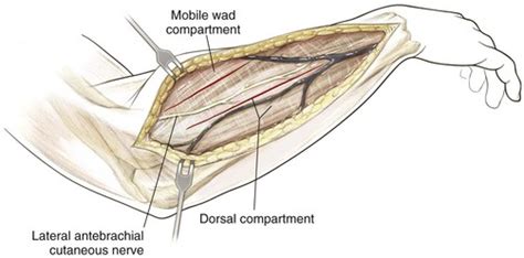 Elbow and Forearm | Musculoskeletal Key