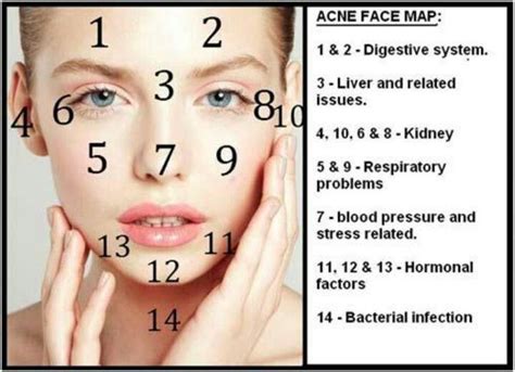 Pin by Rys 👸🍃 on Skin Health | Face acne, Forehead acne, Face mapping acne