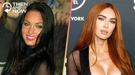 Celebrities Before And After Plastic Surgery