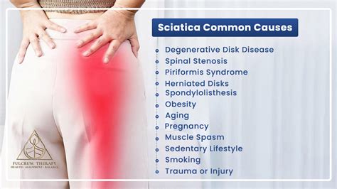 Sciatica: All You Should Know About Sciatic Nerve Pain