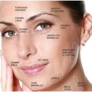 Where Can I Have Botox On My Face?: Chrysolite Aesthetics : Aesthetic ...