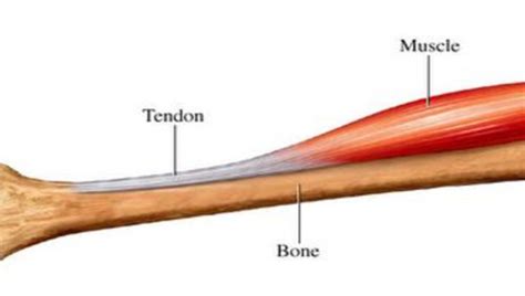 What is a tendon?