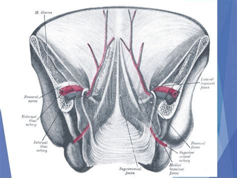 Abdominal incision and abdominal anatomy