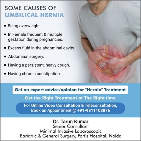 Dr. Tarun Kumar Surgeon: Some Causes of Umbilical Hernia