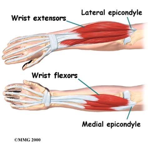 Chapter 5: Muscles of the Wrist and Hand Flashcards | Quizlet