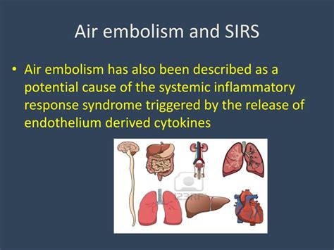 PPT - Venous air embolism (VAE) PowerPoint Presentation, free download ...