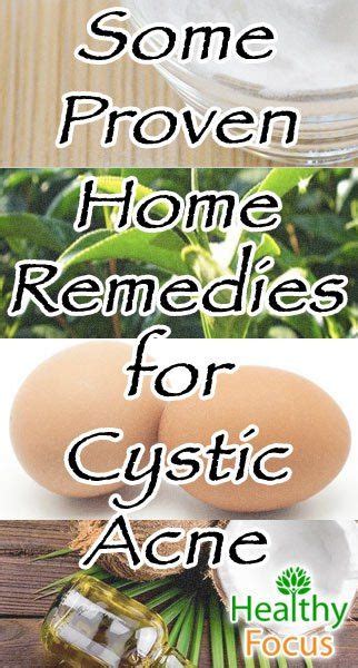 12 Proven Home Remedies for Cystic Acne | Cystic acne remedies, Home ...