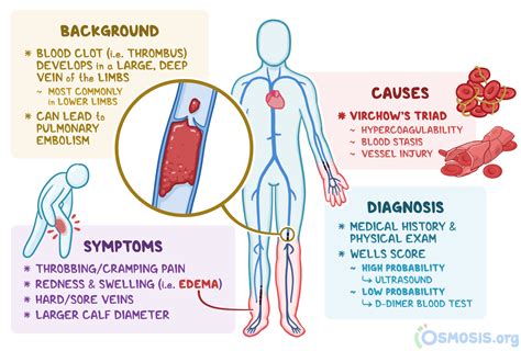 Deep Vein Thrombosis: What is it, Causes, Prevention, and More | Osmosis