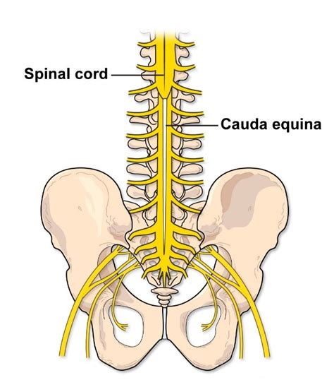 Cauda Equina Syndrome (CES) | Treatments | Patients & Families | UW Health