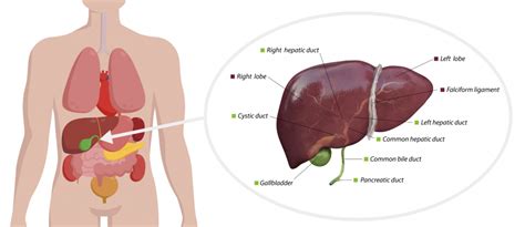 Gallbladder Polyps - Harbour Surgery Centre