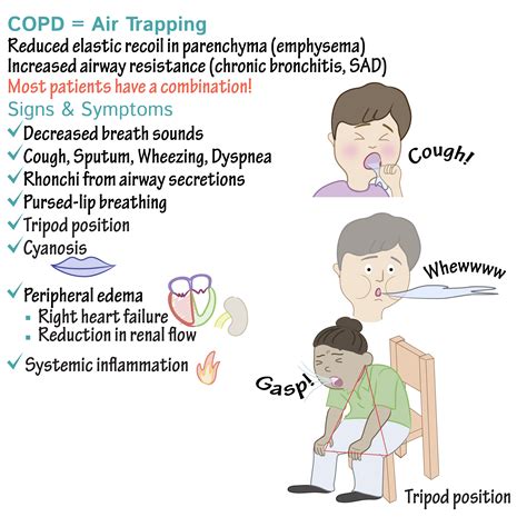 CHRONIC OBSTRUCTIVE PULMONARY DISEASE,WHAT TO KNOW?