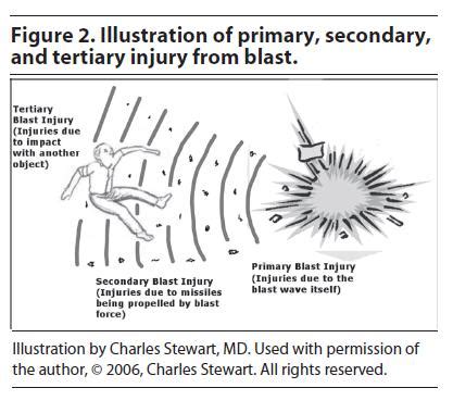 Blast Injuries: Preparing for the Inevitable