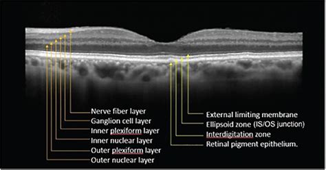 Oct Scan Layers Of Retina