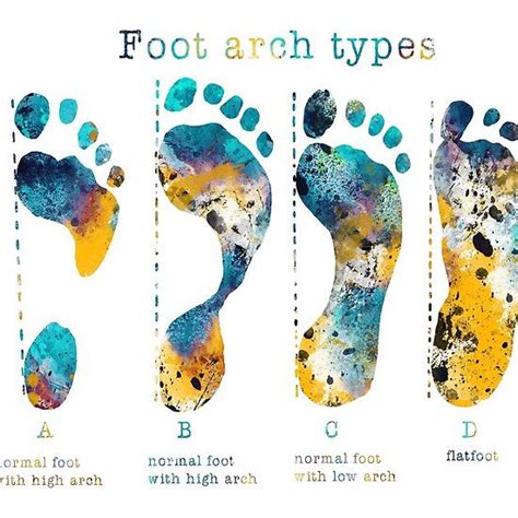 ‘Human types of footprints-foot arch types’ by Rosaliartbook in 2022 ...