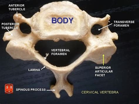 Difference Between Cervical and Thoracic Vertebrae | Compare the ...