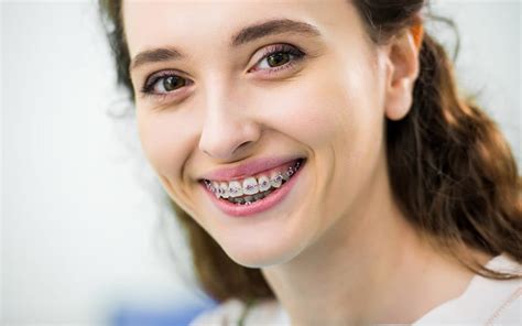 Orthodontics in Phoenix, AZ | Smile Dental Clinics