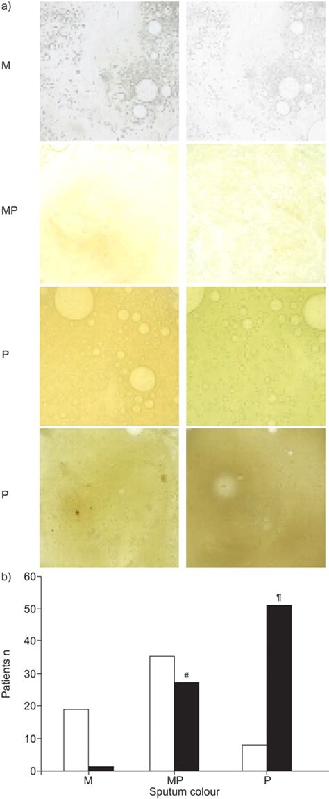 Sputum colour: a useful clinical tool in non-cystic fibrosis ...