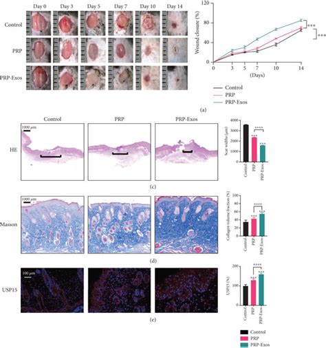 PRP-Exos promote wound healing in C57BL/6 mice. (a) Images of wounds in ...