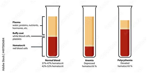 Composition of blood: plasma, buffy coat, hematocrit. Сorrelation ...