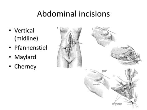 PPT - Pelvic Surgical Anatomy PowerPoint Presentation, free download☹️ ...