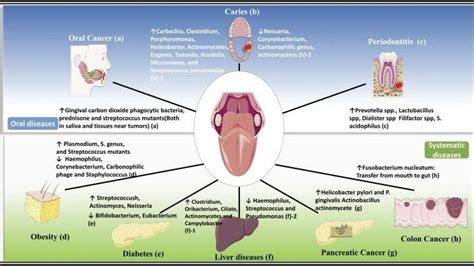 Oral Bacteria... Connected to Other Health Conditions? | Other Omaha NE