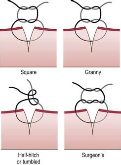 Suturing techniques and common surgical procedures | Veterian Key