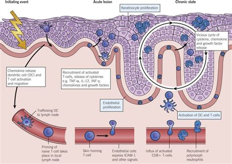 Psoriasis – Biologics | Plastic Surgery Key