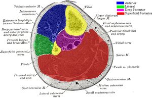 Compartment syndrome - WikEM