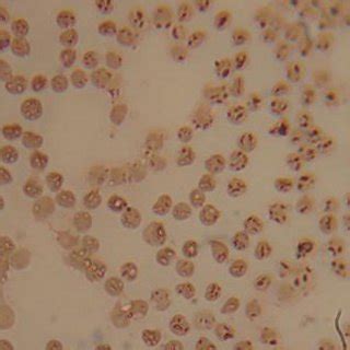 Babesia foliata ( ) in sheep blood smear. Giemsa stain (X 100 ...