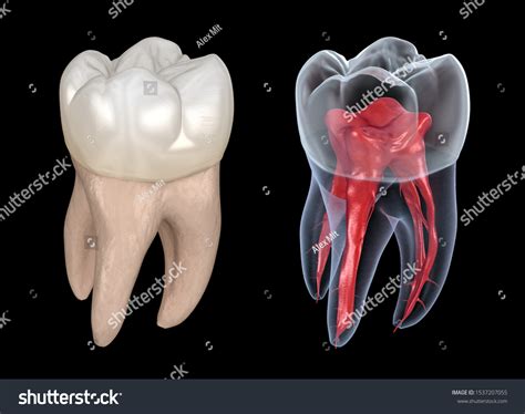 Dental Root Anatomy First Maxillary Molar: ภาพประกอบสต็อก 1537207055 ...