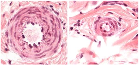 Large Artery Histology