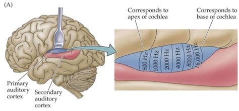 The auditory cortex — Brain & language