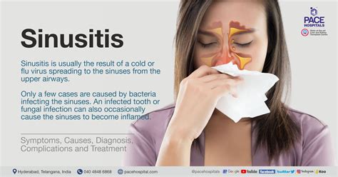 Sinusitis - Types, Causes, Symptoms, Complications and Treatment