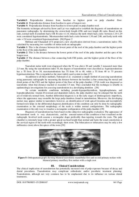 Taurodontism; clinical considerations