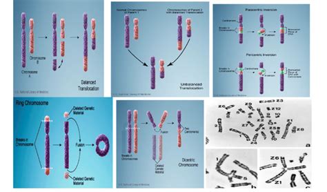 Structural Abnormalities Of Chromosome