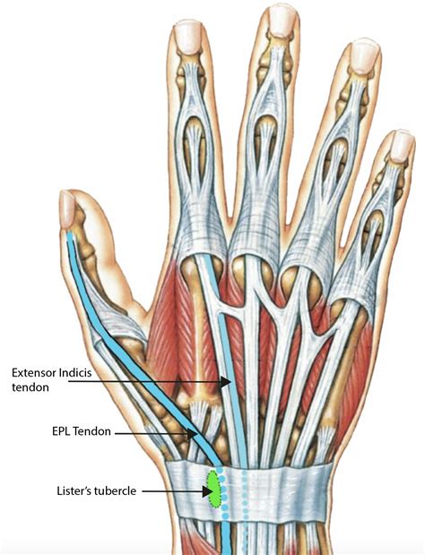 Extensor Pollicis Longus Test