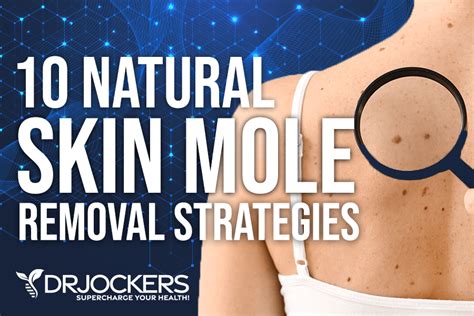 Skin Moles: Signs of Cancer and 10 Natural Removal Strategies