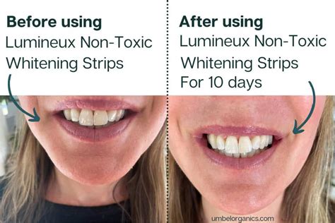 Lumineux Non-Toxic Teeth Whitening Strips Review - Umbel Organics