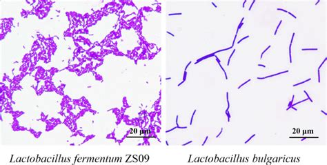 Lactobacillus Casei Gram Stain