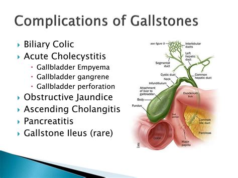 PPT - Gallstone Disease and Acute Cholecystitis PowerPoint Presentation ...