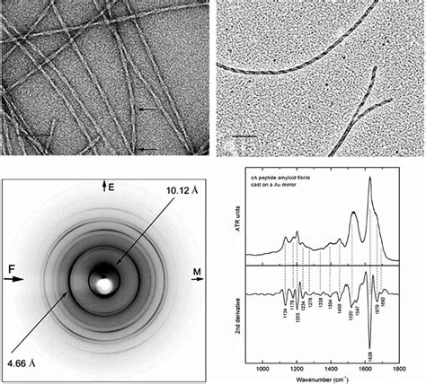 (a) Electron micrograph of amyloid-like fibrils derived by ...